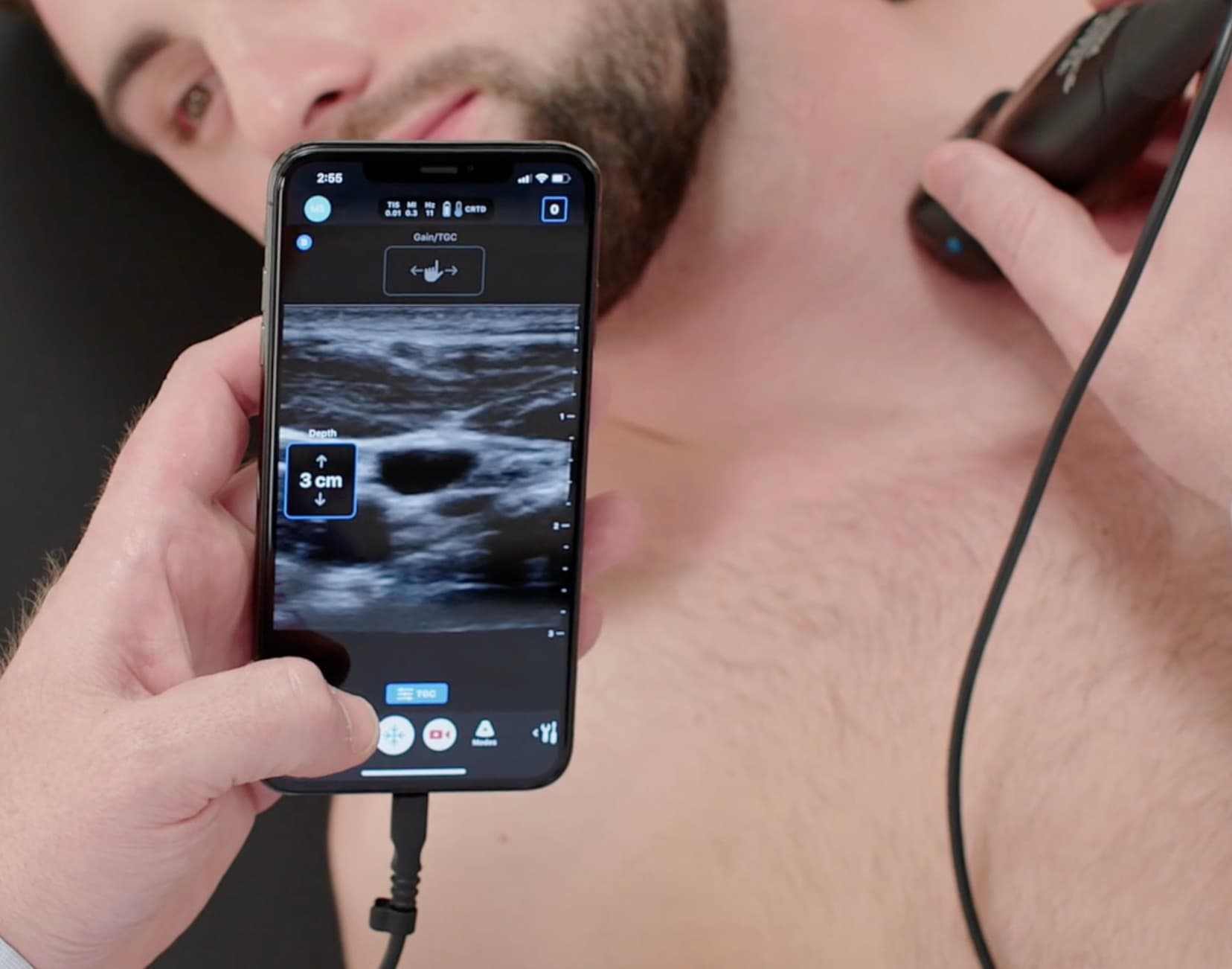 Portable ultrasound for EMS paramedics Butterfly iQ3